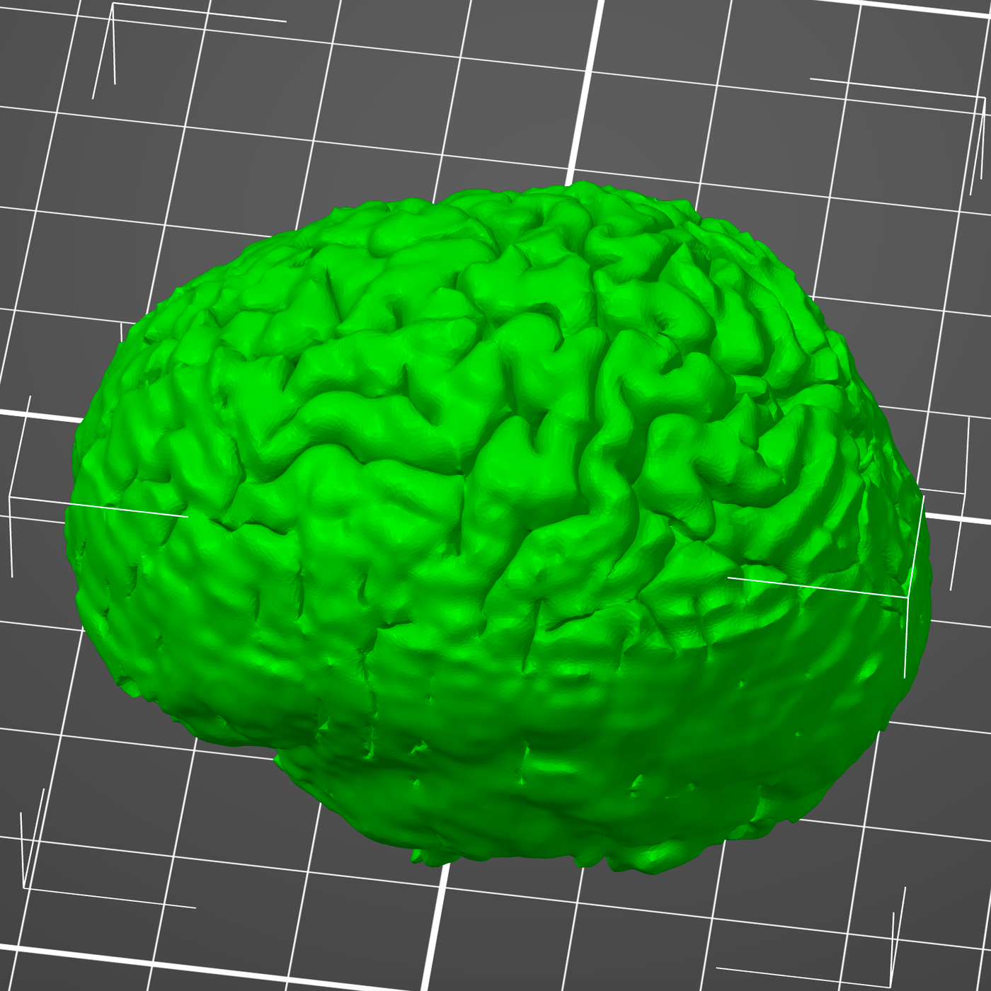 brain_stl